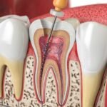 Sri Sai Dental and Implant Centre